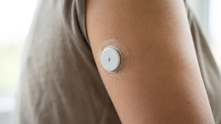 Wearables and Real-Time Health Tracking: Do Continuous Glucose Monitors Actually Help If You Don’t Have Diabetes?